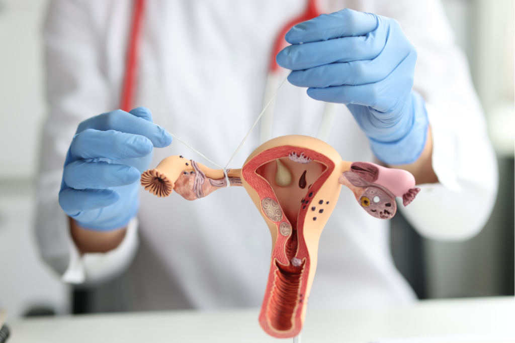 Tratamento de trompa antes da FIV: médica explica hidrossalpinge para paciente